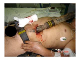 Drilling_accident.pps
